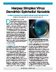 Herpes Simplex Virus Dendritic Epithelial Keratitis